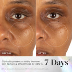Exo-PDRN Prismatic+ before and after, skin texture in 7 days