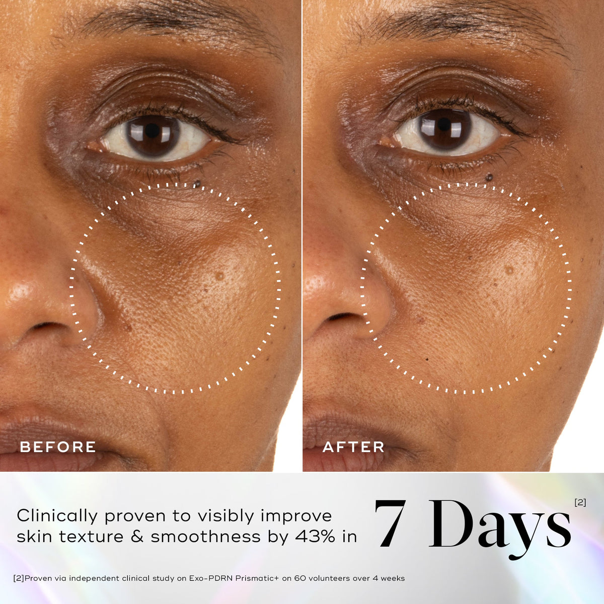 Exo-PDRN Prismatic+ before and after, skin texture in 7 days