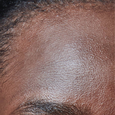 Close-up of dry, dehydrated skin on the forehead - skincare for dry and dehydrated skin